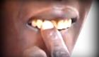 Haiti Senator Wencesclas Lambert Broke Daniel Theodore's Teeth