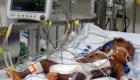 Haiti Medical - Conjoined Twin separated in Mirebalais University Hospital